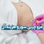 مزو چربی سوز