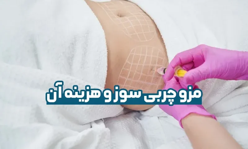 مزو چربی سوز