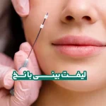 لیفت بینی با نخ