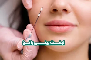 لیفت بینی با نخ
