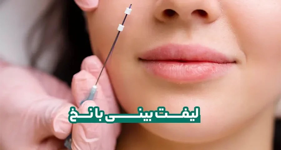 لیفت بینی با نخ