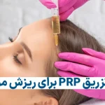 پی آر پی مو