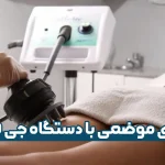 لاغری موضعی با دستگاه جی فایو