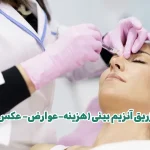 تزریق آنزیم بینی