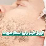 تزریق فیلر برای اسکار صورت و هزینه آن