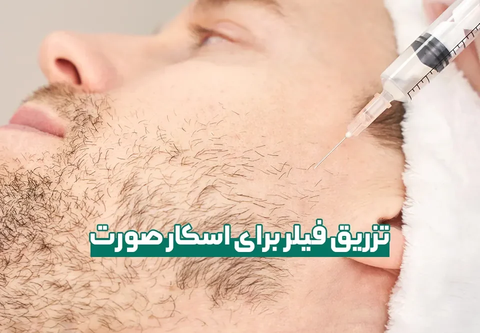 تزریق فیلر برای اسکار صورت و هزینه آن