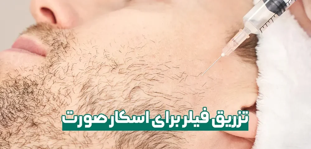 تزریق فیلر برای اسکار صورت و هزینه آن