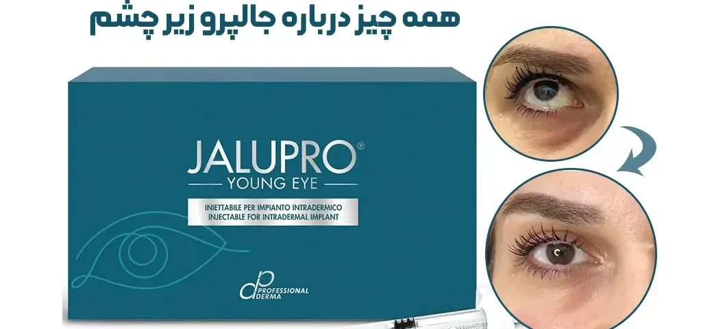 جالپرو زیر چشم