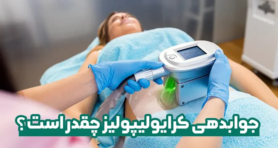 جوابدهی کرایولیپولیز چقدر است