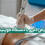 عوارض لاغری با دستگاه کویتیشن