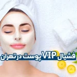 فشیال VIP پوست در تهران