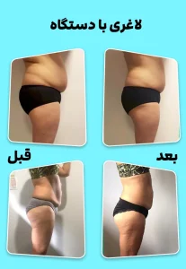 لاغری با دستگاه