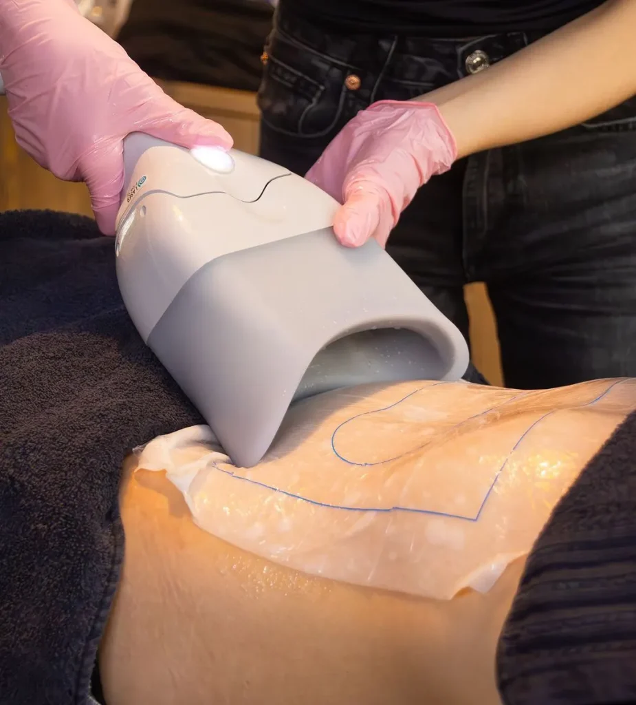 لاغری با دستگاه تهران