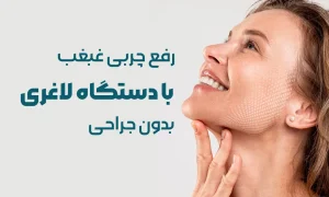 لاغری غبغب با دستگاه