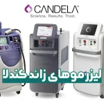 لیزر موهای زائد کندلا