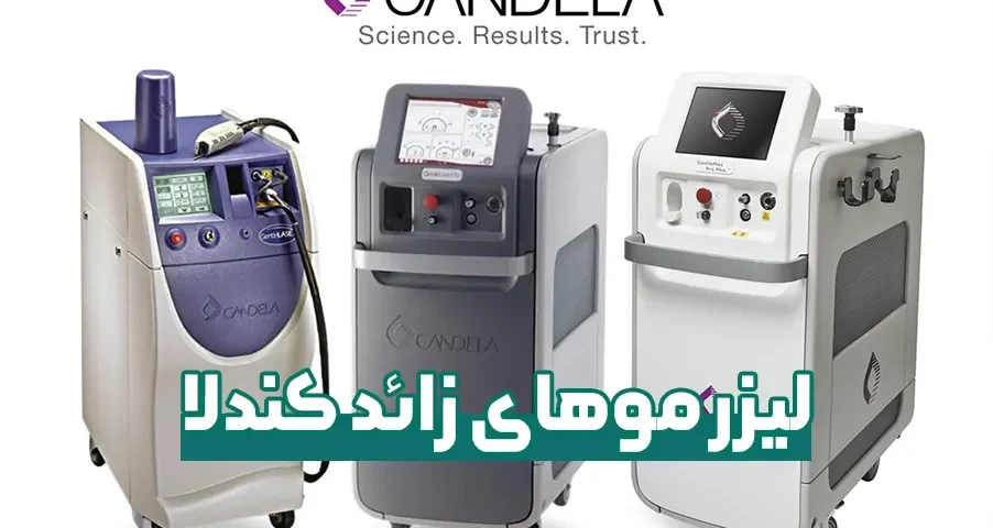 لیزر موهای زائد کندلا
