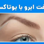 لیفت ابرو با بوتاکس