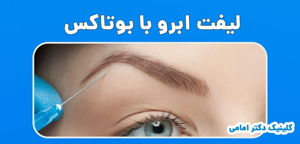 لیفت ابرو با بوتاکس