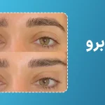 لیفت ابرو با نخ