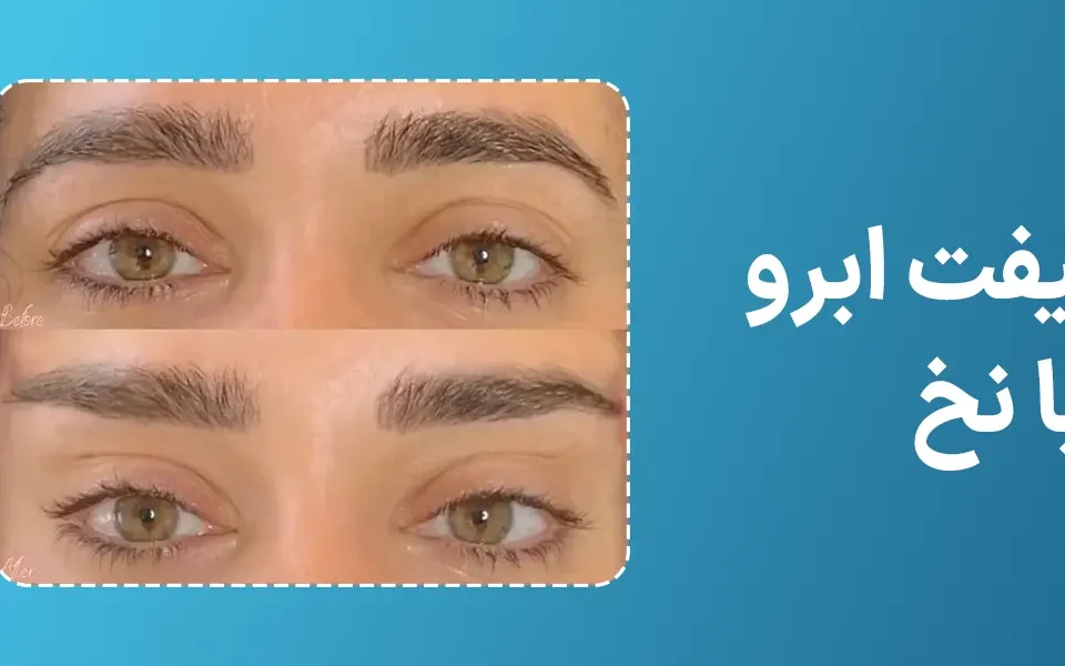 لیفت ابرو با نخ