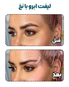 لیفت ابرو با نخ