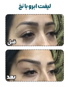 لیفت ابرو با نخ