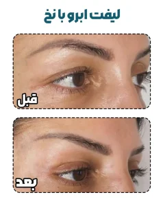 لیفت ابرو با نخ