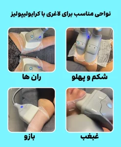 نواحی مناسب برای لاغری با کرایولیپولیز