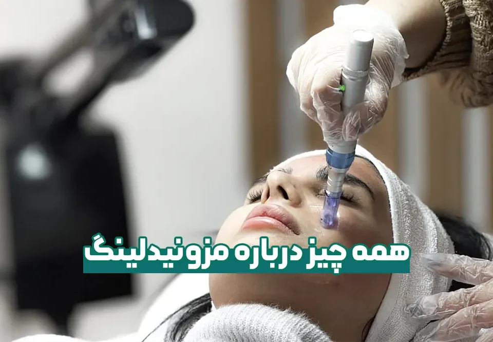 مزونیدلینگ