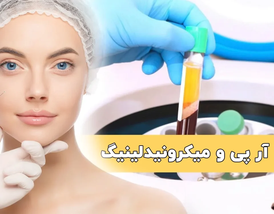 پی آر پی و میکرونیدلینگ