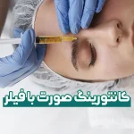 کانتورینگ صورت با فیلر