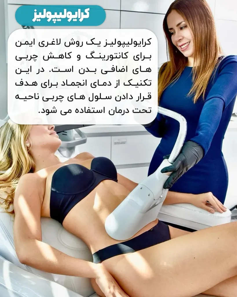 کرایولیپولیز